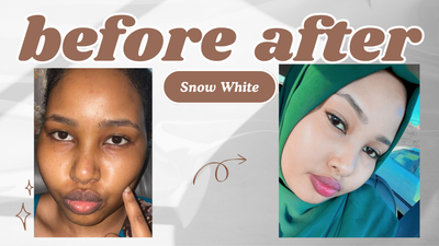 30 Days Using Grerivian Snow White Lightening Lotion: What to expect!