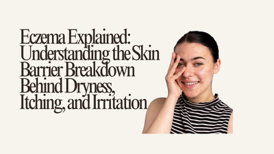 Eczema Explained: Understanding the Skin Barrier Breakdown Behind Dryness, Itching, and Irritation