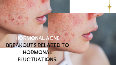 Hormonal Acne – breakouts related to hormonal fluctuations.