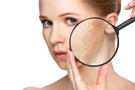 How to treat my severe dry skin with Grerivian solution & Alternative Home remedies D.I.Y. People who have dry skin can often get skin irritations like skin roughness, skin dryness & skin patches